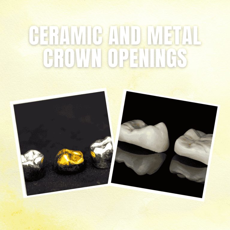 Why Do We Use Different Burs for Ceramic and Metal Crown Openings?