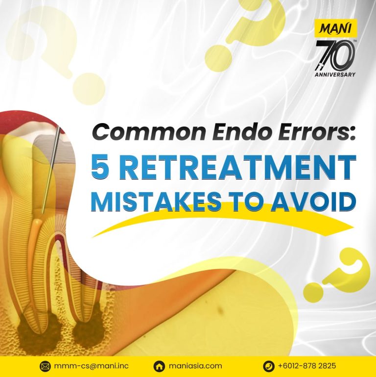Common Endo Errors: 5 Retreatment Mistakes to Avoid